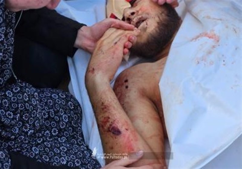 درخواست نظام پرستاری برای برخورد با جنایت رژیم صهیونیستی